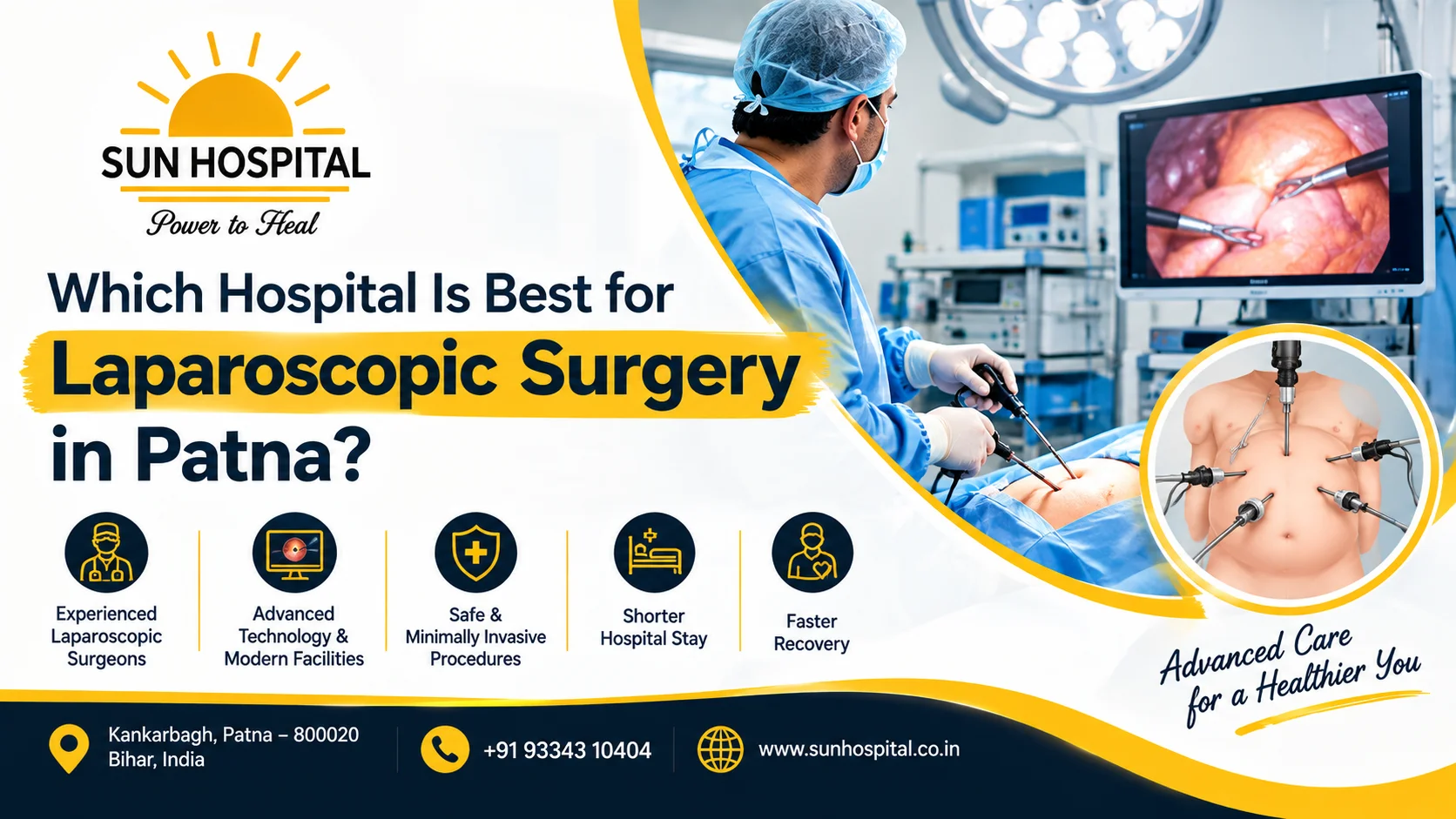 Best for laparoscopic surgery in Patna with advanced surgical care